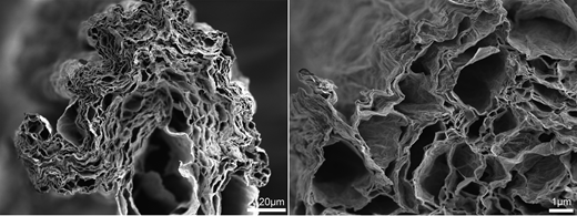 Electron microscopy of graphene yarns